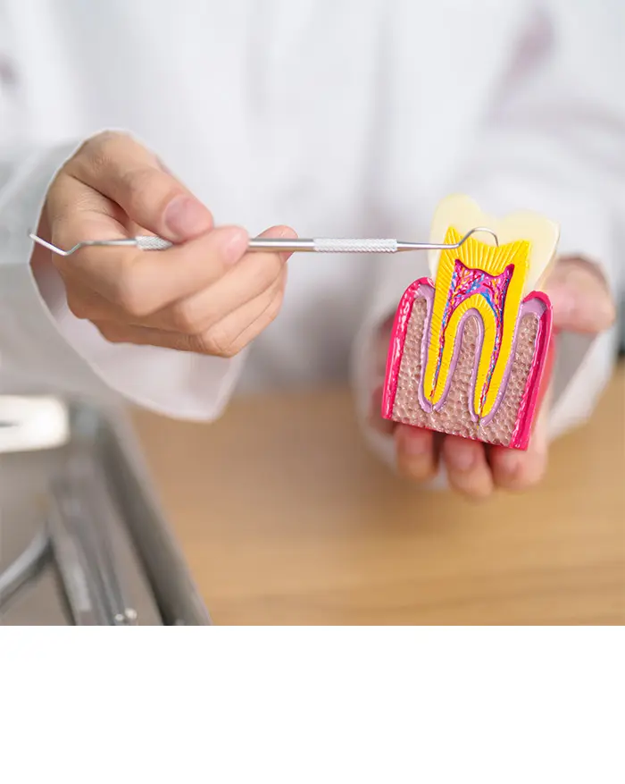 Endodonti (Kanal Tedavisi)